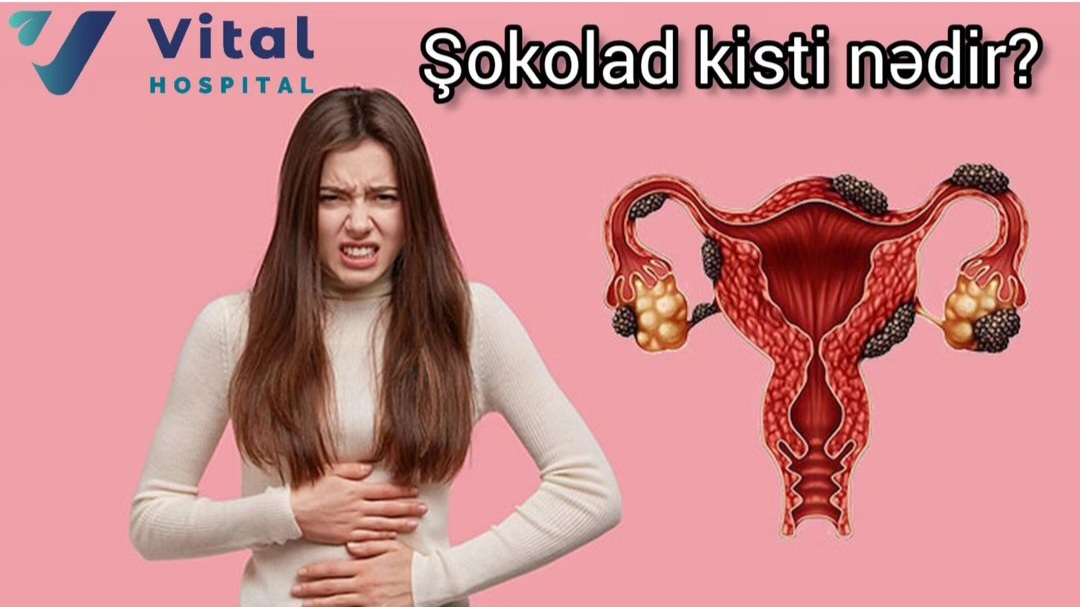 Ginekoloji CHECK-UP 92 azn